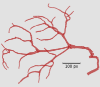 Image showing the extracted tubular network of Drosophila trachea